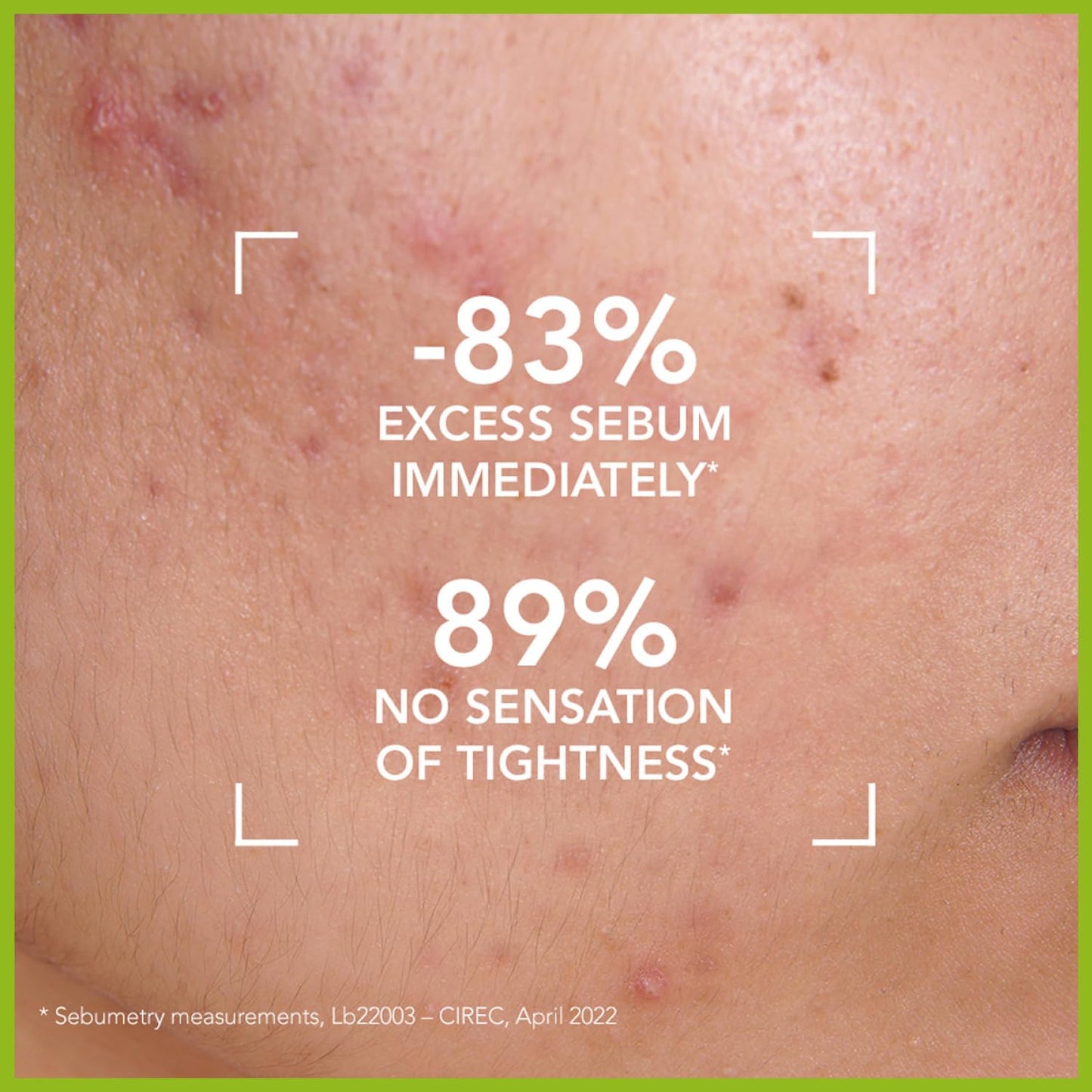 Bioderma - Sébium - Foaming Gel Pump - Cleansing and Make-Up Removing - Skin Purifying